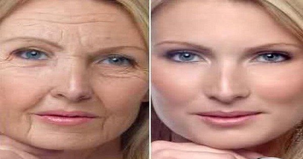 how to get rid of face wrinkles after weight loss